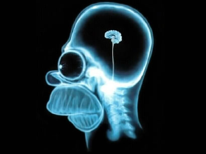 Homer Simpson's brain x-ray