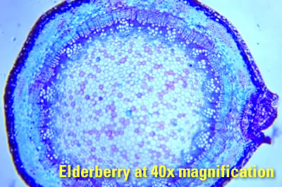 smartphone microscope 4