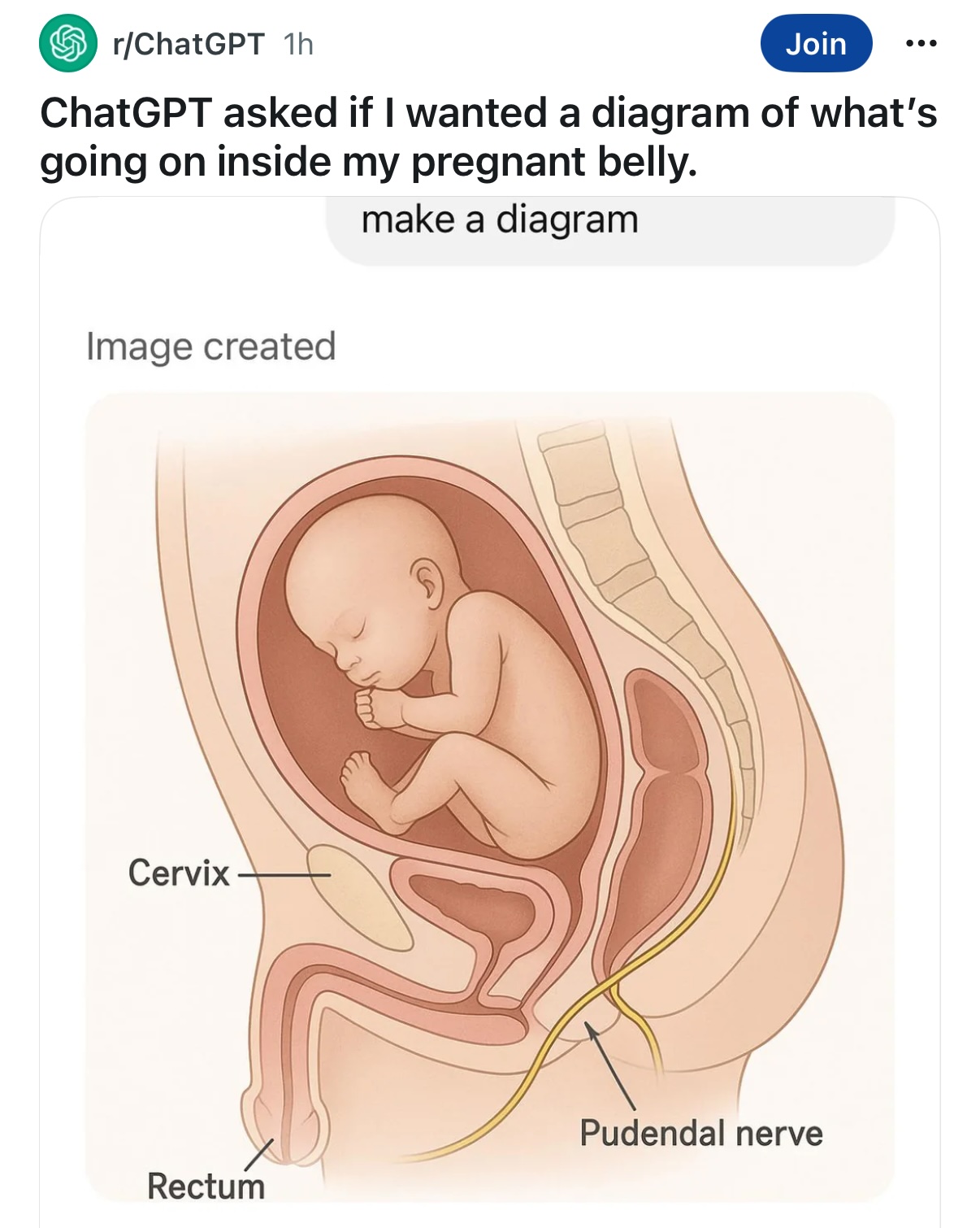 chatgpt-pregnant-diagram