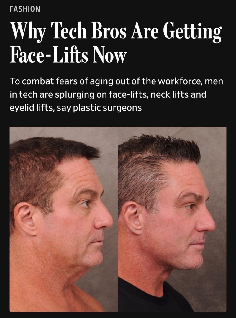 why-tech-bros-are-getting-face-lifts-now