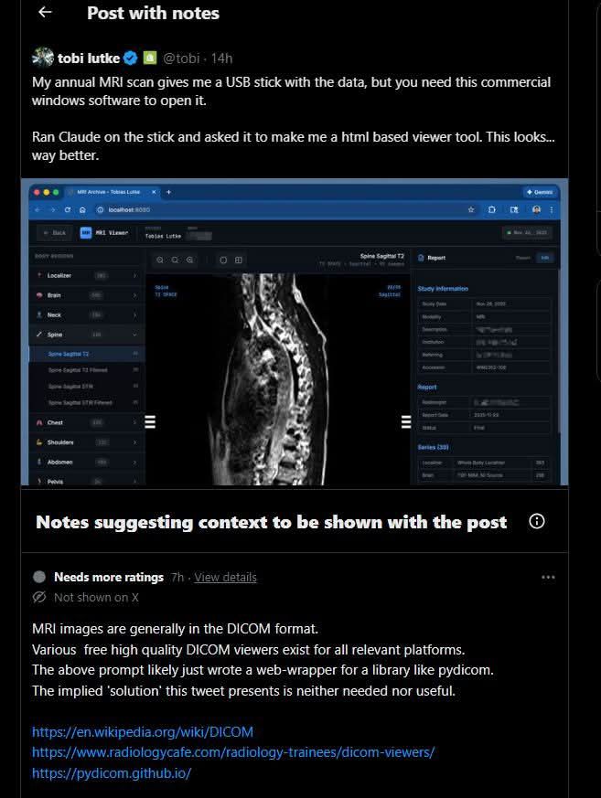 community-notes-on-tobi
